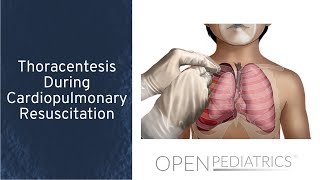 Thoracentesis During Cardiopulmonary Resuscitation by S. Townsend, C. Weldon | OPENPediatrics