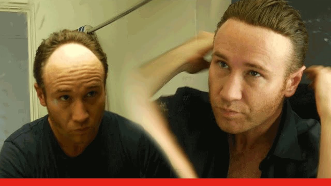 Video 11: Cutting and fitting my hairpiece