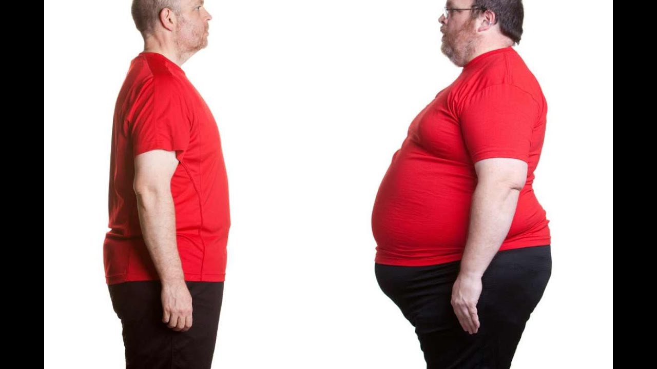 Ожирение 2 Степени У Женщин Фото — Фото Картинки