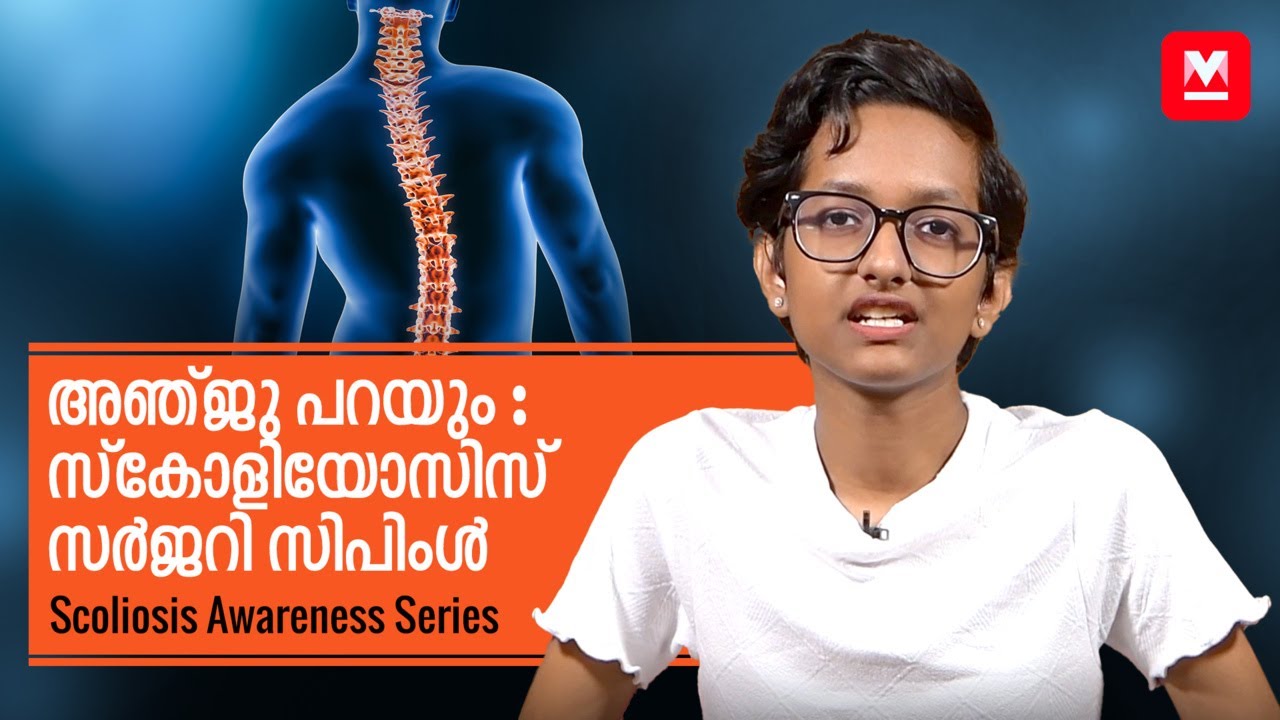 അഞ്ജു പറയും : സ്കോളിയോസിസ് സർജറി സിപിംൾ | Scoliosis Awareness Series