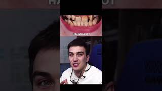 Как исправить неправильный прикус комплексно: зубы, дыхание, осанка.