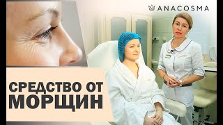 Как убрать морщины на лице? | Филлер Белотеро | Бланшинг | АНА КОСМО Как убрать морщины на лице? | Филлер Белотеро | Бланшинг | АНА КОСМО