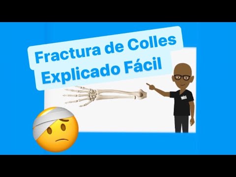 FRACTURA DE COLLES  🥺 FRACTURA DE RADIO DISTAL
