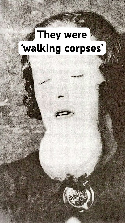 The Horrifying Story of The Radium Girls - Science's Dark Secret