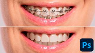 Remove Braces in Photoshop | Easy Pro-Level Results by Photoshop Training Channel 25,090 views 1 year ago 4 minutes, 48 seconds