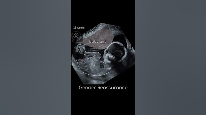 Ultrasound report Baby Boy or Girl? 12 weeks Gender Reveal 🤗 #shorts