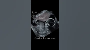 Ultrasound Report Baby Boy Or Girl 12 Weeks Gender Reveal Shorts 