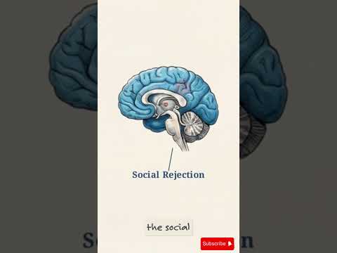 Negativity Bias- Why Criticism Feels Like a Threat #shorts #psychology  #criticisms