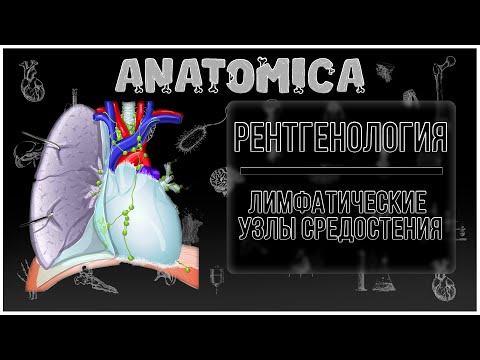 Лимфатические узлы средостения / Компьютерная томография / Рентгенология