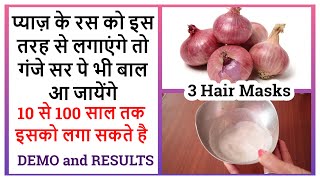 Onion Juice for Hair Growth | Onion Hair Mask | Hair Regrowth |Pyaz ka Ras for Hair | Onion Hair Oil