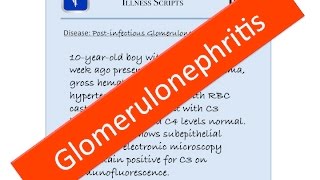 Postinfectious (Post-streptococcal) Glomerulonephritis Illness Script - USMLE, Medicine, Pediatrics