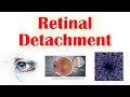 Retinal detachment  types risk factors pathophysiology signs  symptoms diagnosis treatment