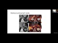 Virtual SBRT and SRS Remote Training Session 2: Prostate/Bone Mets