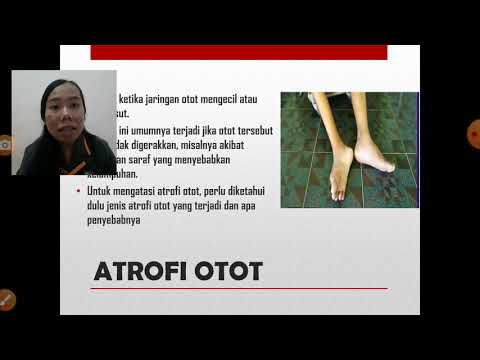 Video: Atrofi Otot Gluteal