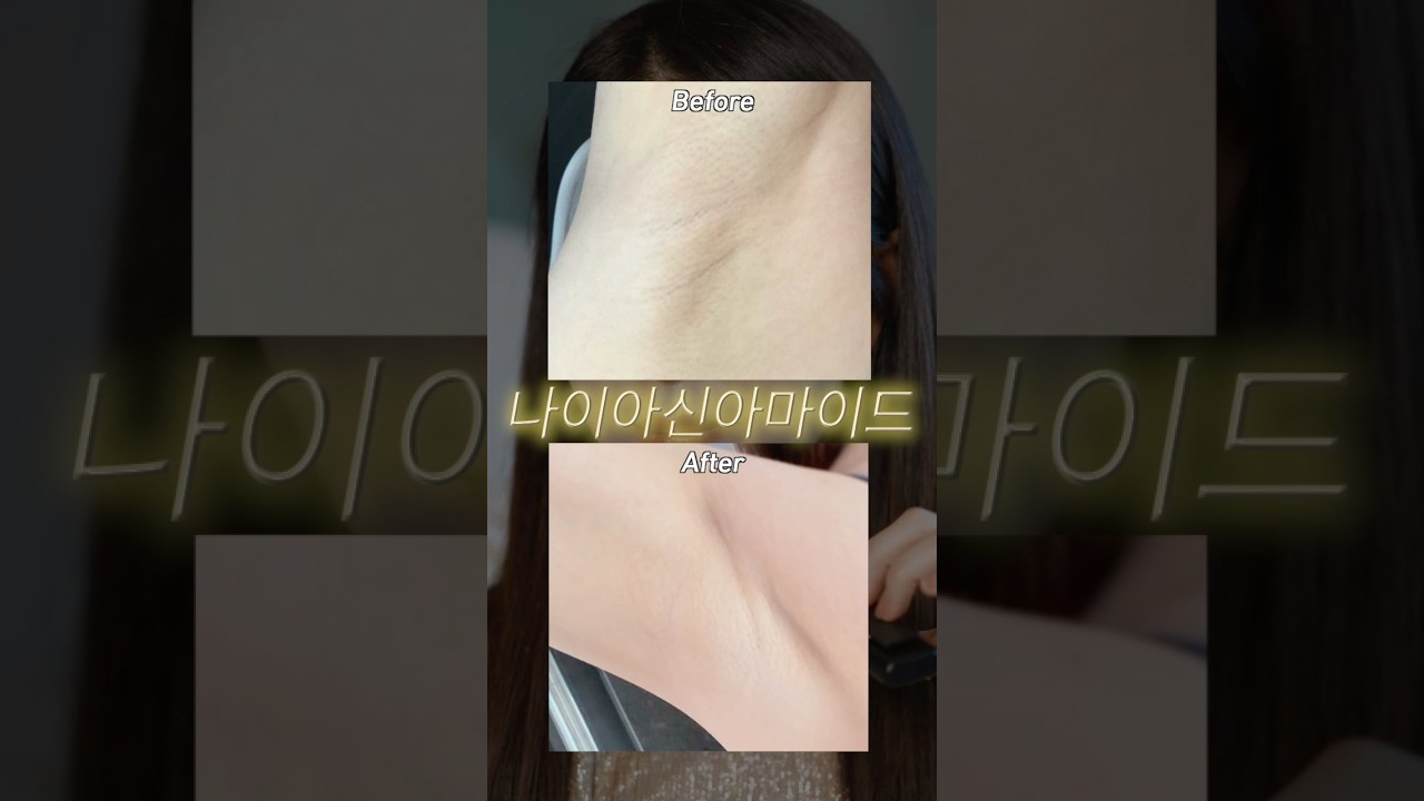 요즘 사람들 겨드랑이 까만 이유