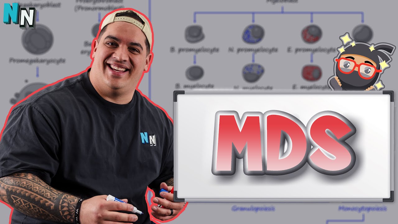 Myelodysplastic Syndrome (MDS) | Clinical Medicine