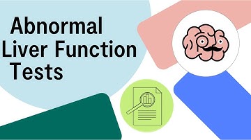 UKMLA AKT Abnormal LFTs - Liver Function Tests | Multiple Choice Questions