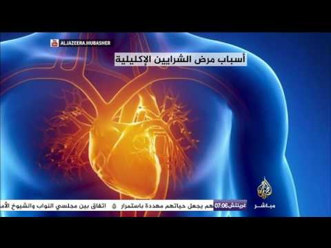 نصائح علاج أمراض القلب