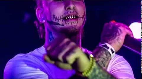 Stitches - Drug Dealer