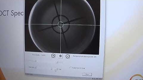 Solix Calibration - Service Video - 3 - Fundus Camera Alignment