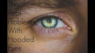 THE PROBLEM & SOLUTIONS FOR VERY HOODED EYES!