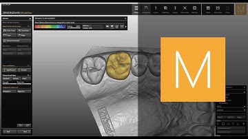 Our design software, Zirkonzahn.Modellier! | Zirkonzahn.Software