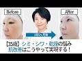 【シミ・シワ・乾燥とサヨナラ】実績日本一のエステの肌改善がスゴイ
