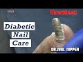 Diabetic Nail Care - Clipper, Medicool Drill, Curette