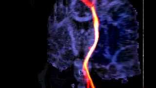Stochastic DT-MRI Connectivity Mapping on the GPU