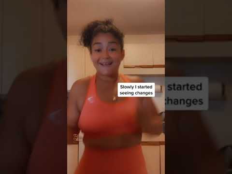 Apple Cider Vinegar Gummies Benefits Shorts Gummies Applecidervinegarbenefits