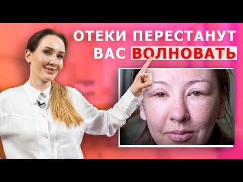 Причины отёков на лице и как от них избавиться | Как убрать отёки на лице и что нельзя делать!