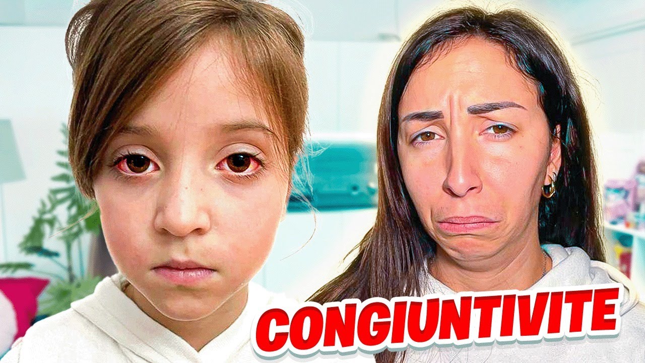 FIGLIACHIARA MALATA HA PRESO LA CONGIUNTIVITE AGLI OCCHI! #mammagiuliafigliachiara #mgfc