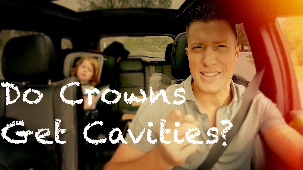 Do Crowns Get Cavities? YouTube