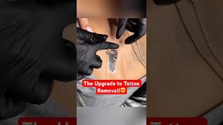 This Patch Makes Tattoo Removal Faster