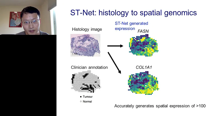 Deep learning to integrate histology with spatial transcriptomics