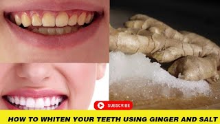 How To Whiten Your Teeth Using Ginger And Salt