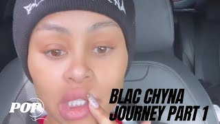 Blac Chyna Removes Her Facial Fillers