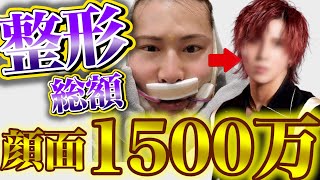 【ホスト】ホストは整形当たり前!?ダメホスにもいた!整形費用に1500万円使いました。【歌舞伎町】