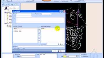 Ax.CEPH Analysis type wizard (Analysis type from scratch)