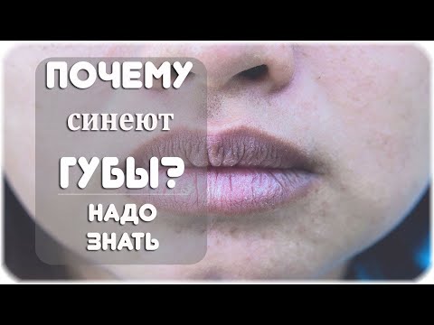 Почему синеют губы?