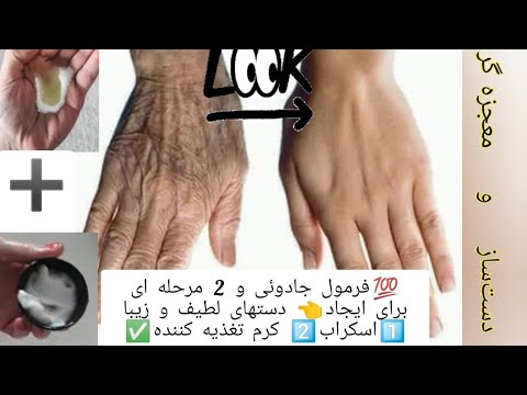 تصویری: 3 راه برای جلوگیری از ایجاد پینه روی دست