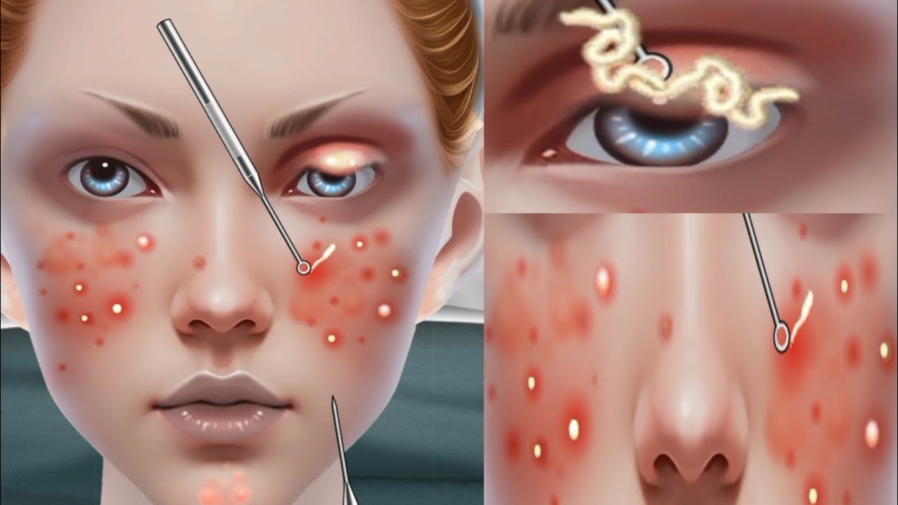 Asmr face cleaning, wash, Treatment, makeup, pimple massage, touching