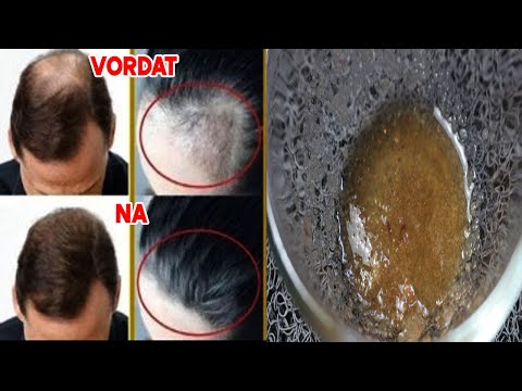Video: 19 Kruiden Voor Haargroei