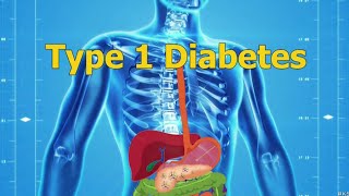 New insulin regulating implant helps type 1 diabetes patients