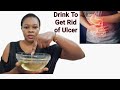 I FOUND THE BEST WAY TO TREAT ULCER NATURALLY INEXPENSIVE | HOW TO TREAT ULCER
