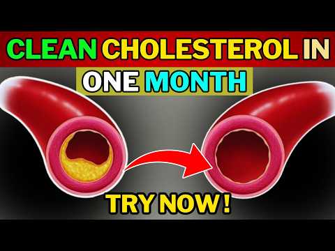 Pogledajte video sa savetima za smanjenje holesterola i triglicerida Video o tome kako smanjiti masnoću u krvi i trigliceride prirodnim putem