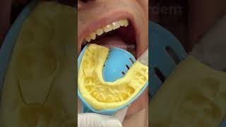 ¿Notas algo raro en esta impresión dental? 😉 Cuéntanos si sabes lo que es👇