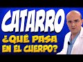 CATARRO - ¿Qué pasa en el cuerpo de quienes lo padecen?