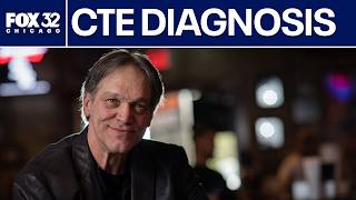 Famous Steve ‘Mongo’ McMichael diagnosed with CTE after death | ChicagoLIVE Wealth