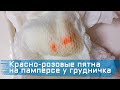 Красно-розовые пятна на памперсе у грудничка (девочка/мальчик, 3-9 месяцев). Уратные камни. Наш опыт